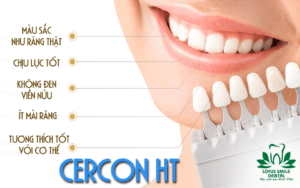 Sứ Cercon HT – Giải pháp phục hình răng sứ cao cấp tại Lab Hoàng Bảo 1 Sứ Cercon HT – Răng sứ cao cấp tại Lab Hoàng Bảo